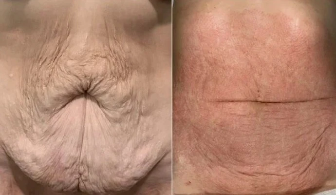 before and after