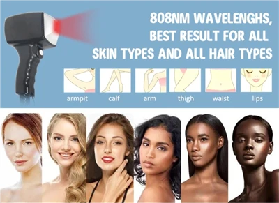 Which Laser Is Best For Hair Removal?
