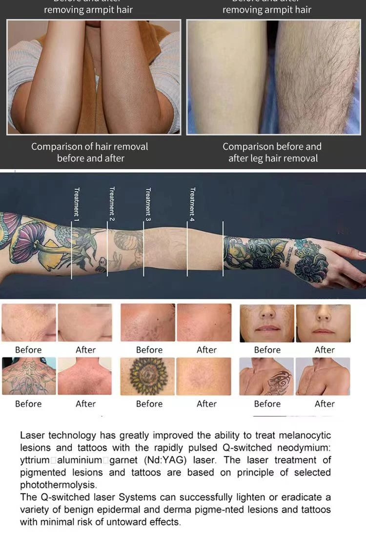 before and after before and after