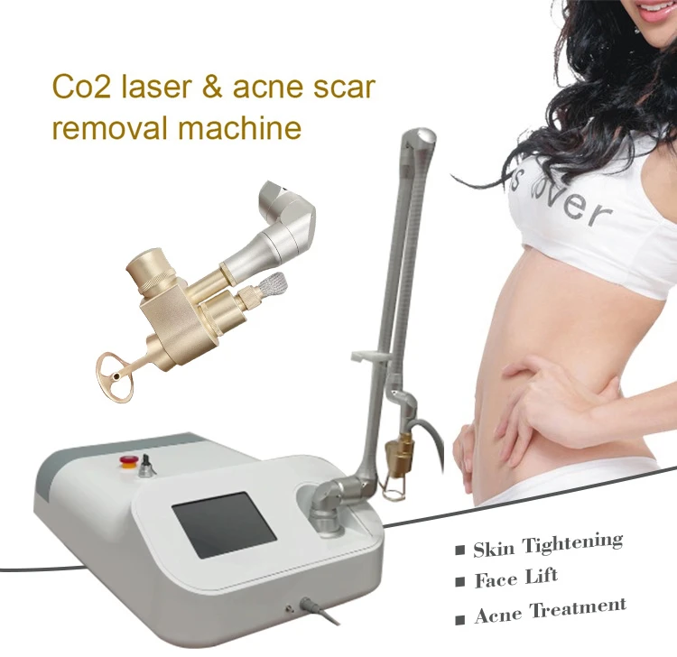 removal machine removal machine