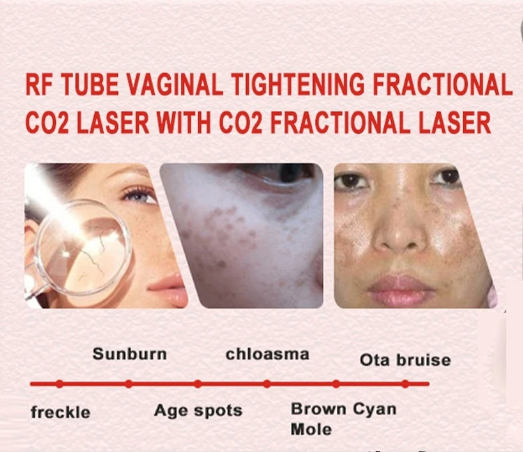 tube
