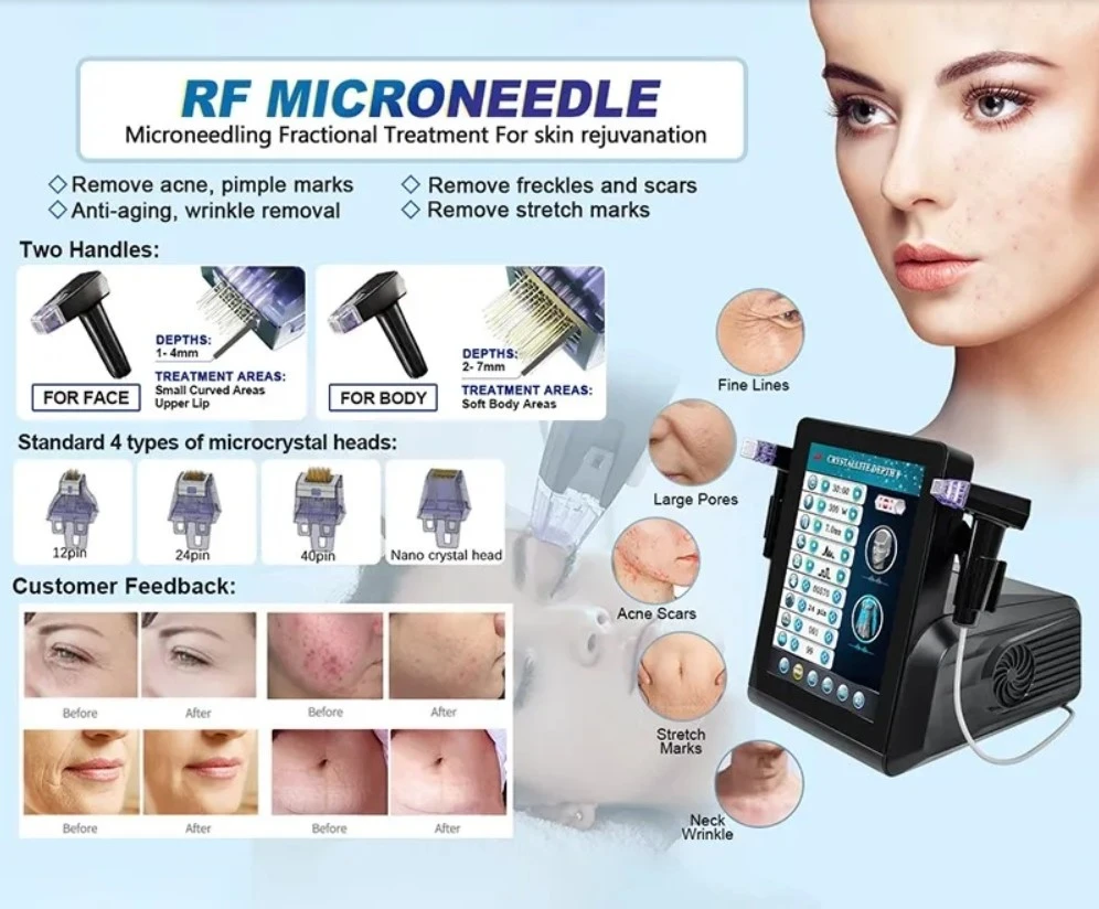 Fractional RF Microneedling Morpheus 8 Machine 6