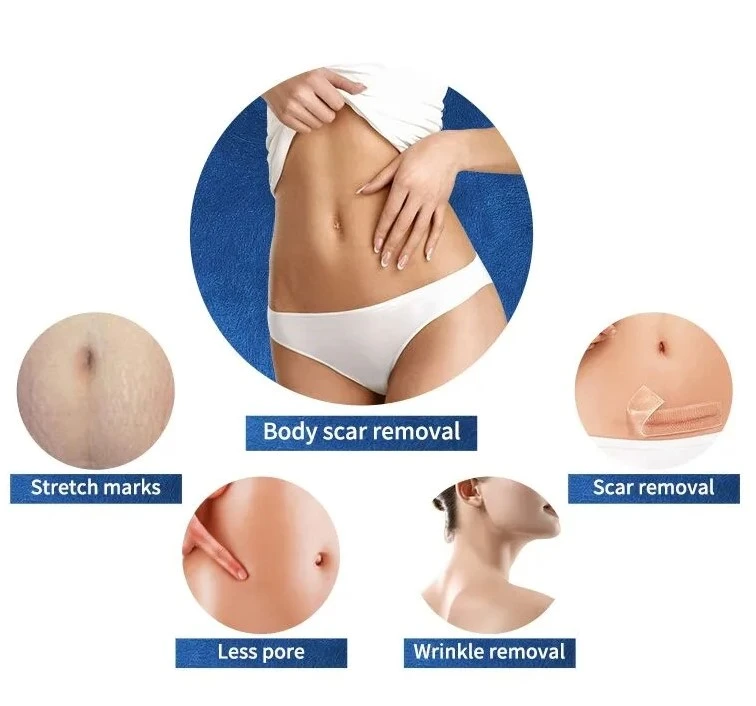 Morpheus 8 Machine 3