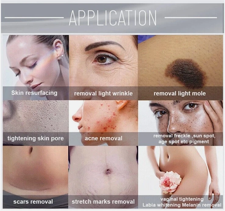 Co2 Laser Skin Resurfacing Machine 2