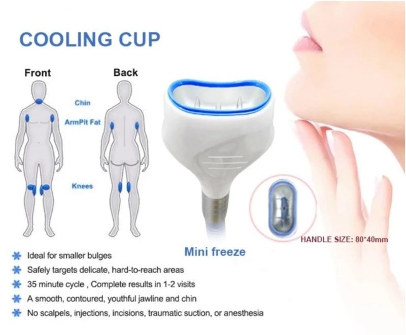 Cryolipolysis Machine 1 Cryolipolysis Machine 1