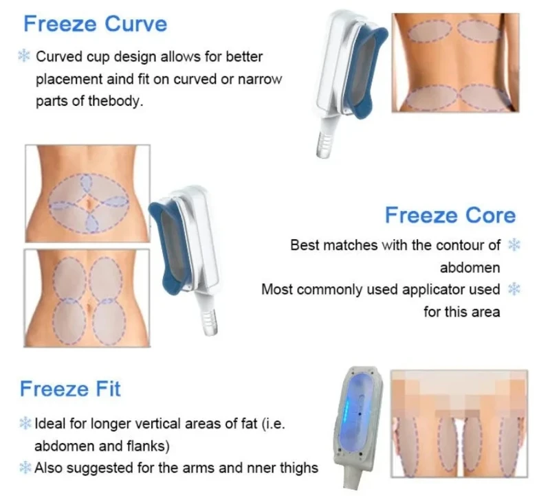 360 Cryoslim Machine 6 360 Cryoslim Machine 6