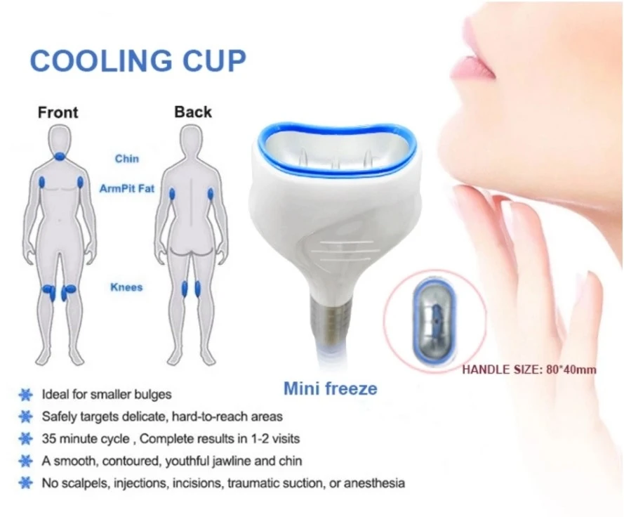 Cryolipolysis Machine 1