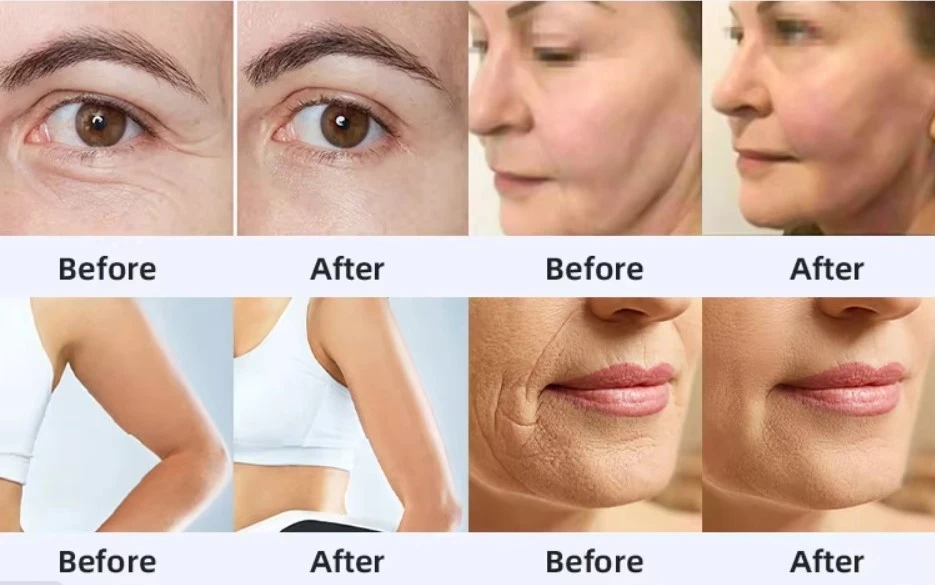 Before & After 