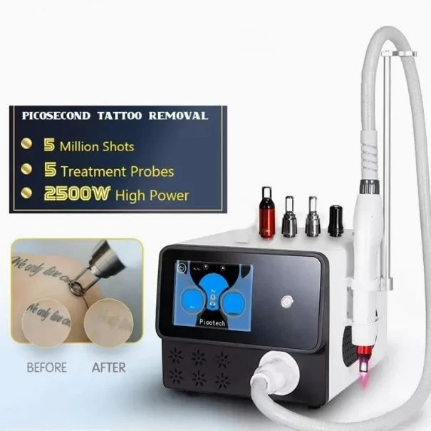 Q Switched ND YAG Laser Tattoo Removal Machine